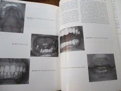 Diseases of the Tempormandibular Apparatus : A Multidisciplinary Approach 1977