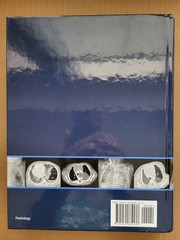 Expertddx : Pediatrics by Alexander J. Towbin, Bernadette L. Koch, et al.– NEW!