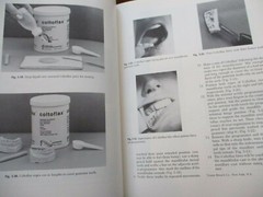 Diseases of the Tempormandibular Apparatus : A Multidisciplinary Approach 1977