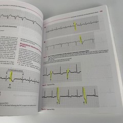 ECG Workout, Seventh Edition / 7th Ed. Jane Huff, Exercises in Arrhythmia Interp