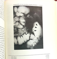 Organ Transplantation The Surgical Clinics of North America Lot of 2 Books 1976